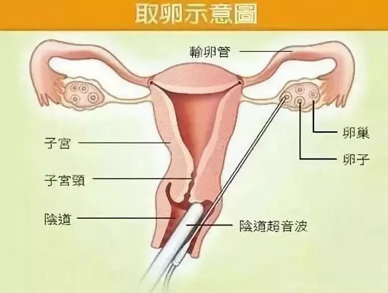无知少女为钱卖卵,后果有多可怕你知道吗?