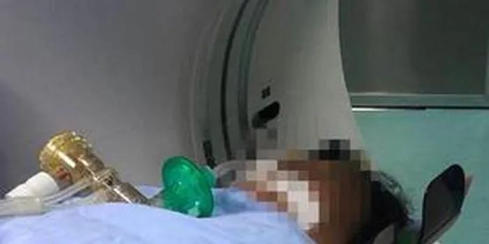痛心!只因吃了这个,一家9口人全部中毒死亡!99%肝脏坏死!澳洲华人注意!这些食物千万不要再吃了!