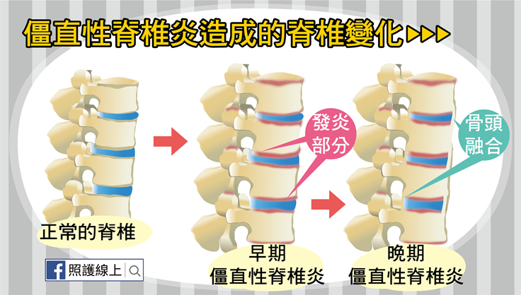 澳洲唐人街